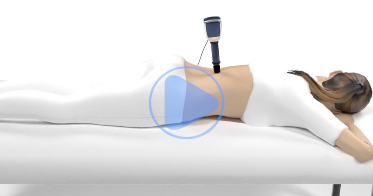 Shockwave - Adhesions