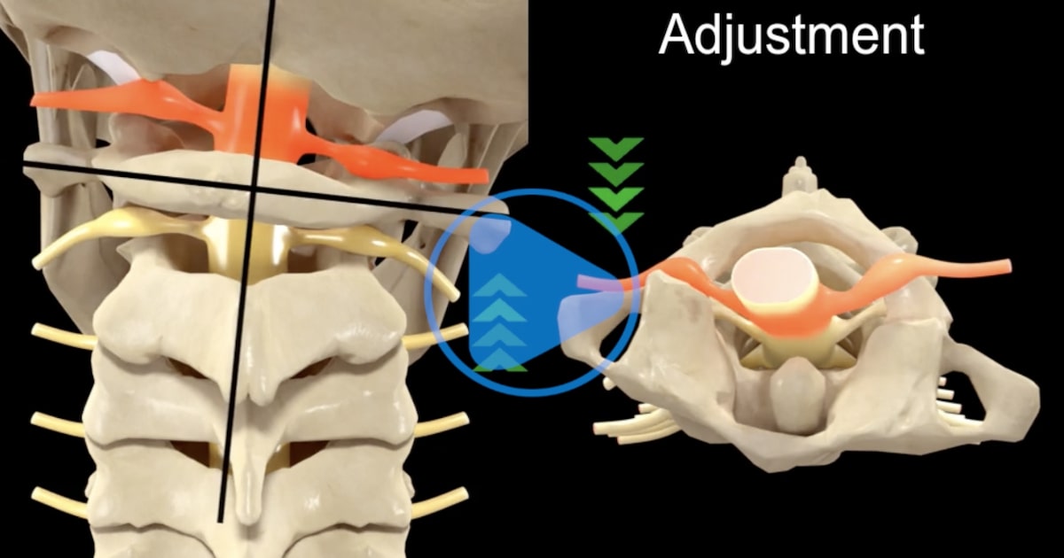 Upper Cervical Adjustment